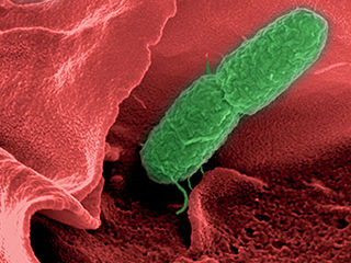 Darmmikrobiota – kleine Helfer gegen Salmonellen