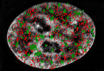 Nano-Blick auf die DNA-Reparatur