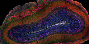 Weit entfernte Gehirnregionen rekrutieren ausgewählte Stammzellen