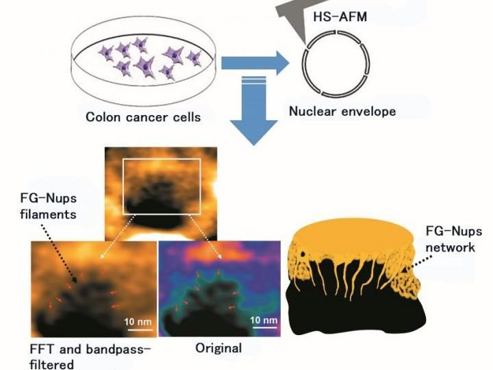 Colon cancer nuclear pore dynamics are captured by HS-AFM