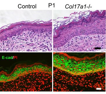 Collagen controlling the thickness and juvenile state of skin