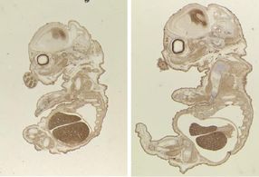 Científicos descubren un gen crítico para el desarrollo de la placenta