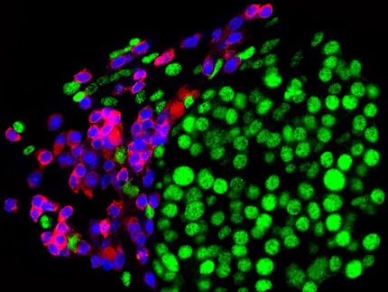 Shedding Light on Cause of Resistance to Tumor Immunotherapy