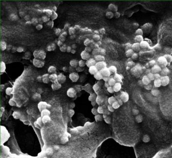 Magnetized viruses attack harmful bacteria