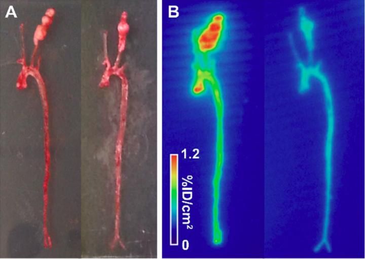 Jakub Toczek, Yunpeng Ye, et al., Yale Cardiovascular Research Center, New Haven, Connecticut