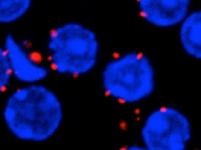 How protein islands form