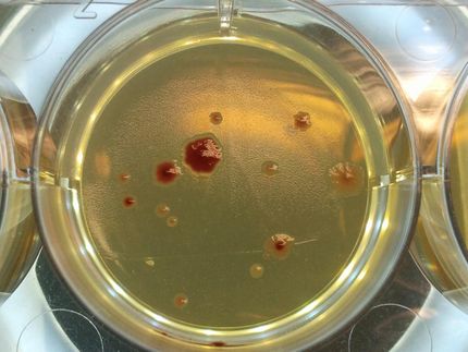 Antibiotic resistance rises in 'lonely' mutating microbes