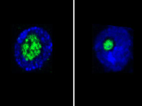 Nucleolus erlaubt Vorhersage der Lebenserwartung