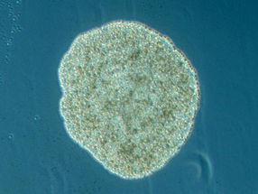 Kleiner gehts nicht: Seltene Genstruktur im Erbgut von Plattentieren entdeckt