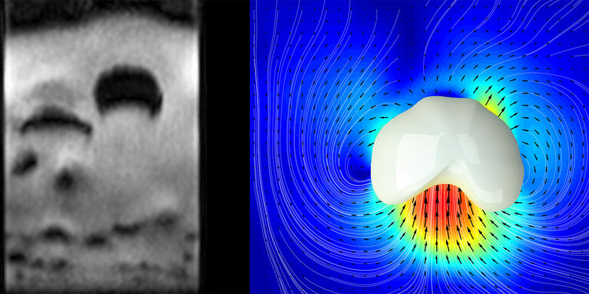 Rapid imaging of granular matter