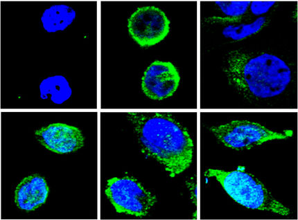 Descubren una nueva diana terapéutica para tratar la metástasis en el cáncer
