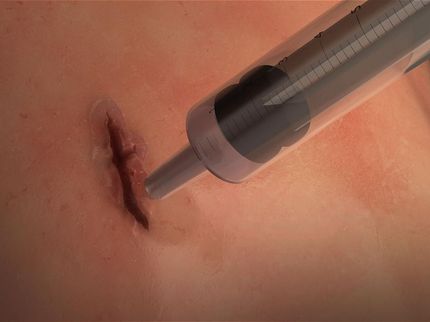 'Squirtable' elastic surgical glue seals wounds in 60 seconds