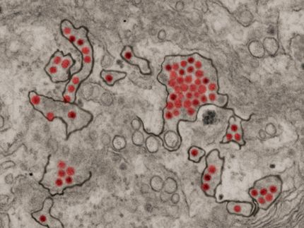 Monoclonal Antibodies Against Zika Show Promise in Monkey Study