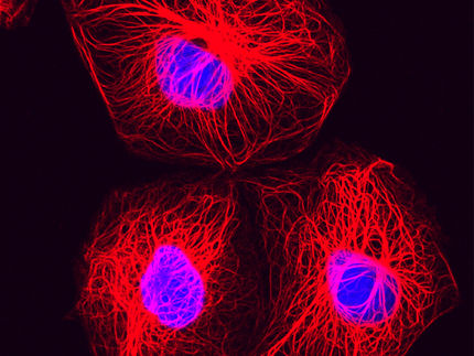 65 neue genetische Risikomarker für Brustkrebs entdeckt