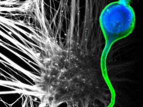 3-D axon assemblies pave the way for drug discovery