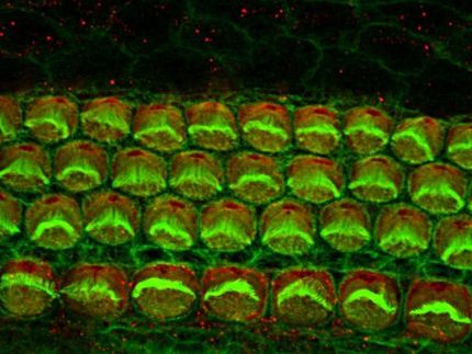 Mistakes in how proteins of the ear are built contribute to early hearing loss