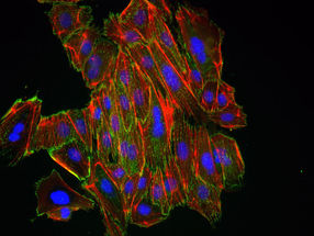 Neu entdeckte microRNA reguliert Mobilität von Tumorzellen