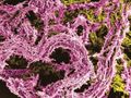 Solving of a decade long mystery could help in fight against TB