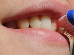 Wie Karies verursachende Bakterien im Zahnbelag überleben können