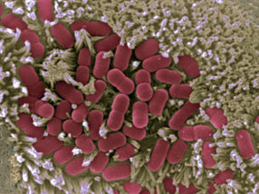 Más cerca de acabar con las infecciones intestinales causadas por E.coli