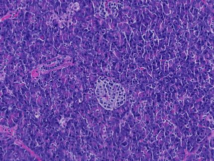 Darmbakterien können autoimmune Krankheiten auslösen