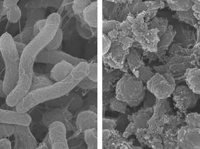 Shape-shifting agent targets harmful bacteria in the stomach