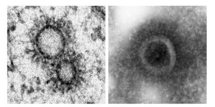El virus de la gripe construye su propio orgánulo para transportar las moléculas