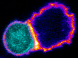Investigadores del CSIC descubren que un grupo de linfocitos activa una respuesta capaz de destruir tumores