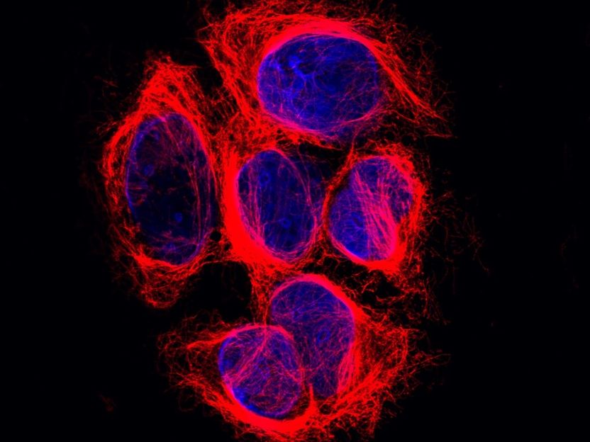 Unexpected finding solves 40-year old cytoskeleton mystery