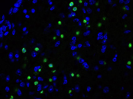 Zelltodblocker gegen Neurodegeneration und Demenz