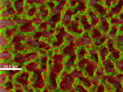 Bakterielle Biofilme detektieren und bekämpfen