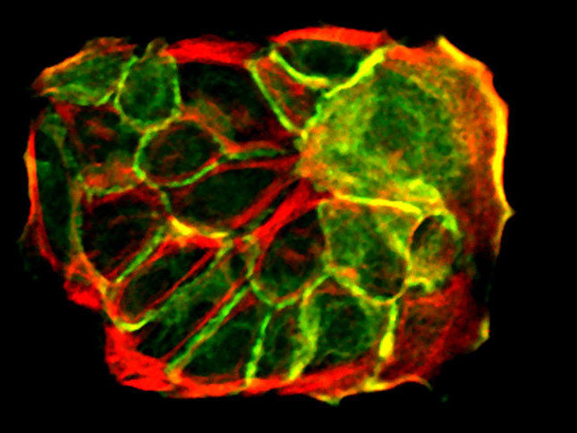 © MPI f. Biologie des Alterns