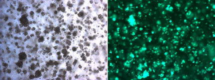Mit 3D-Zellkulturen gegen Krebsresistenzen