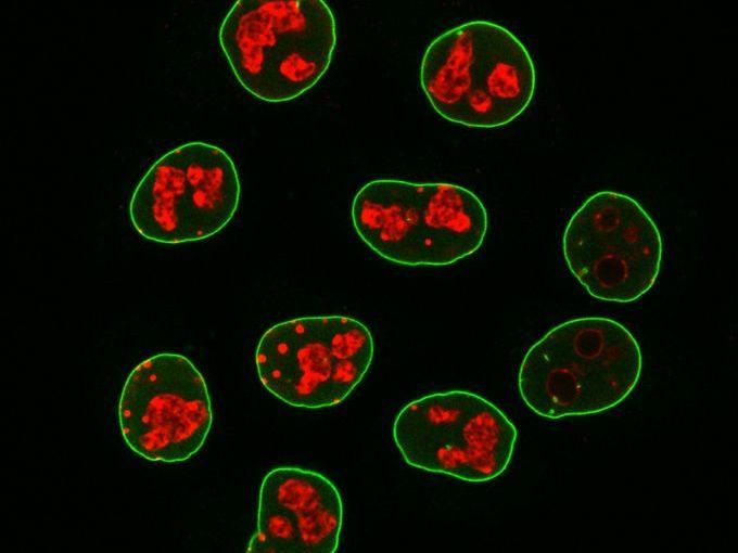 © Tino Pleiner / Max-Planck-Institut für biophysikalische Chemie