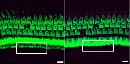 CRISPR treatment prevents hearing loss in mice