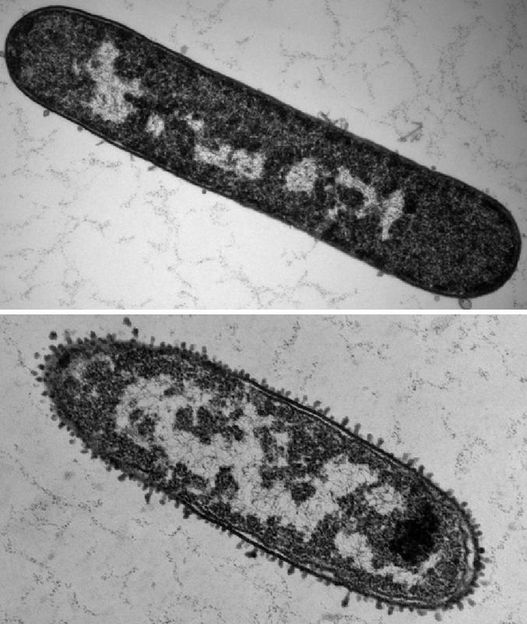 Institut für Molekulare Infektionsbiologie