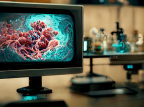 Self-teaching AI uses pathology images to find similar cases, diagnose rare diseases