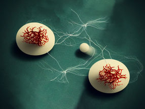 Menschliche Gehirnzellen in einer Schale lernen, Pong zu spielen