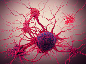 Wie Tumoren die Entstehung von Metastasen unterdrücken