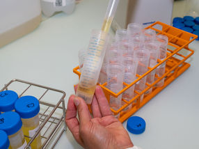 Die Verdaulichkeit von Proteinen im Labor messen und Tierversuche reduzieren