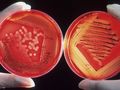 Neue Waffe gegen antibiotikaresistente Bakterien