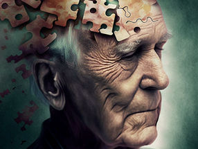 Se encuentra una nueva diana para las terapias contra el Alzheimer