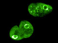 Las esferas de proteínas protegen el genoma de las células cancerosas