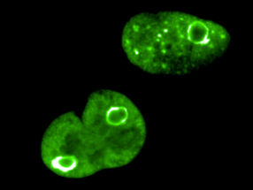Proteinkugeln schützen das Genom von Krebszellen