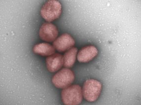 Un estudio del CSIC muestra la presencia del virus de la viruela del mono en el aire y en la saliva de pacientes infectados