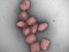 CSIC study shows presence of monkeypox virus in air and saliva of infected patients