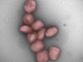 Studie zeigt das Vorhandensein von Affenpockenviren in der Luft und im Speichel von infizierten Patienten