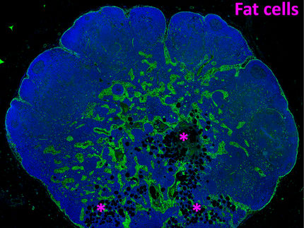 How fat takes over the lymph nodes as we age