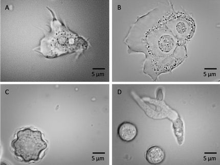 Durchbruch bei der Bekämpfung der Legionärskrankheit