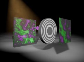 Los investigadores desarrollan un nuevo método para obtener imágenes en color con rayos X